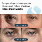 Hydrogel Eye Patches | Max Strength