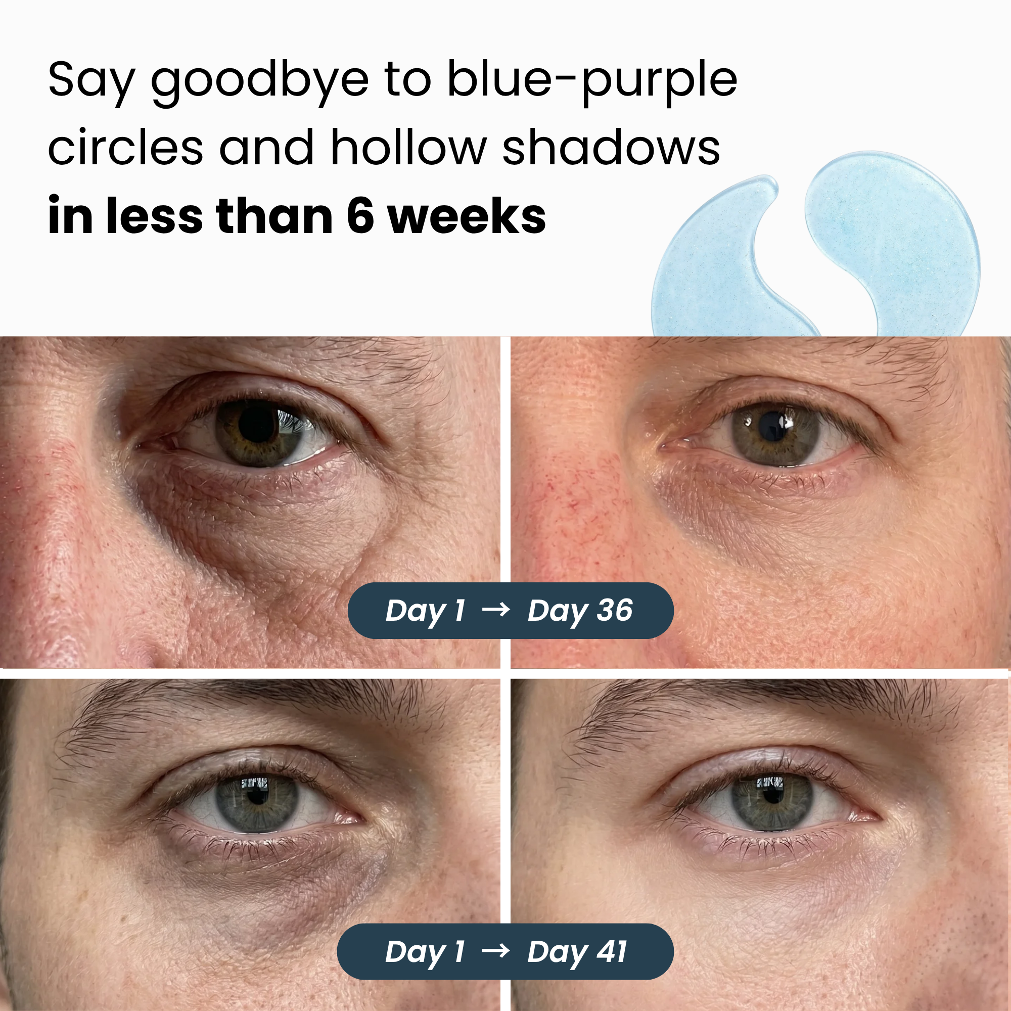 Hydrogel Eye Patches | Max Strength