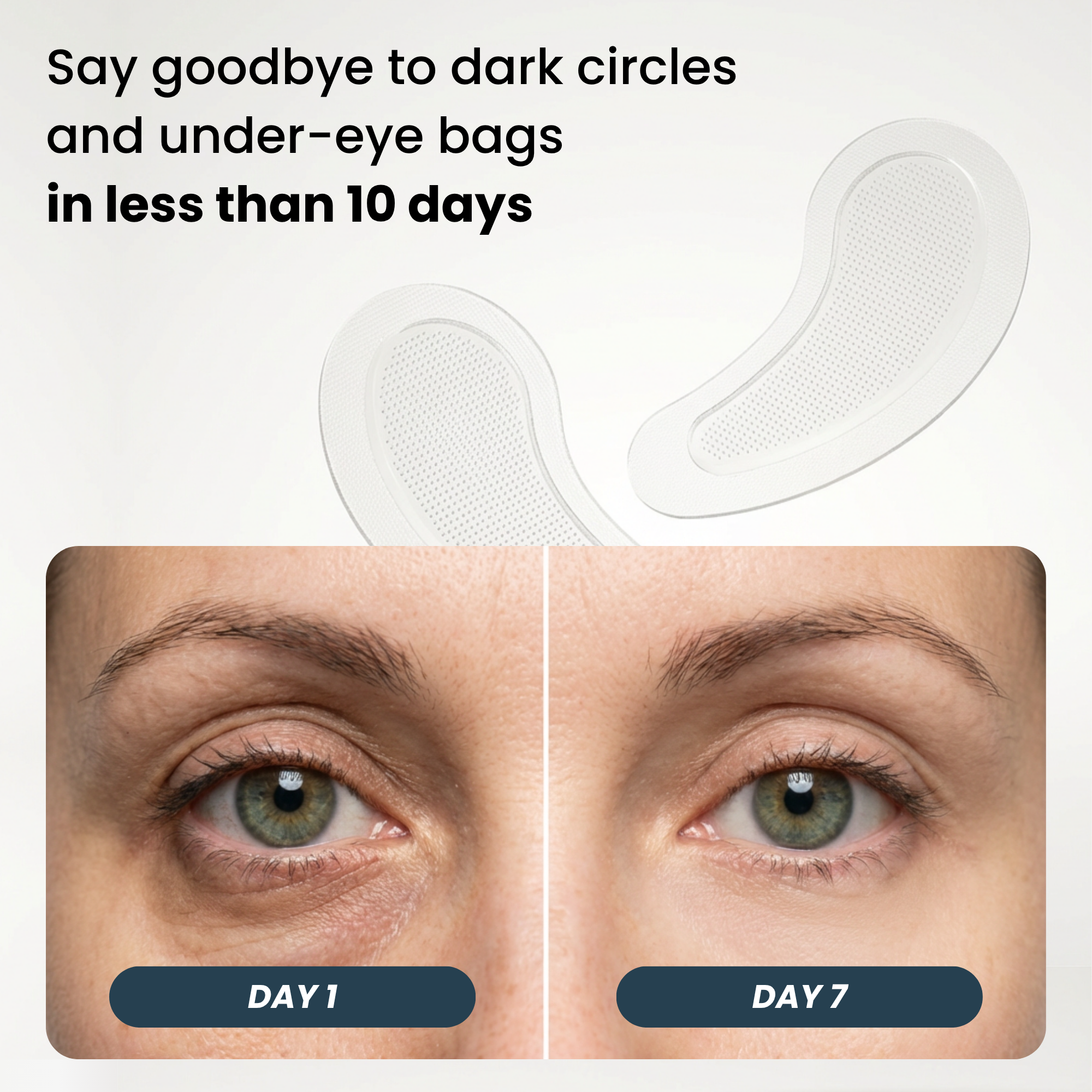 Microneedle Patches | Next Generation