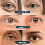 Microneedle Patches | New Generation