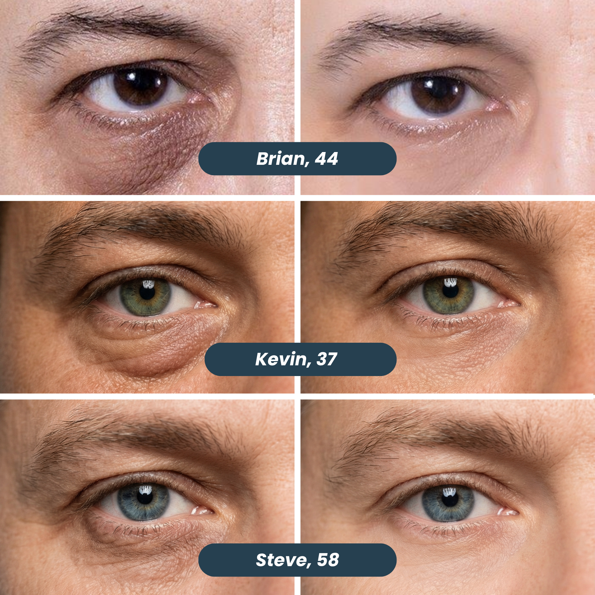 Microneedle Patches | New Generation