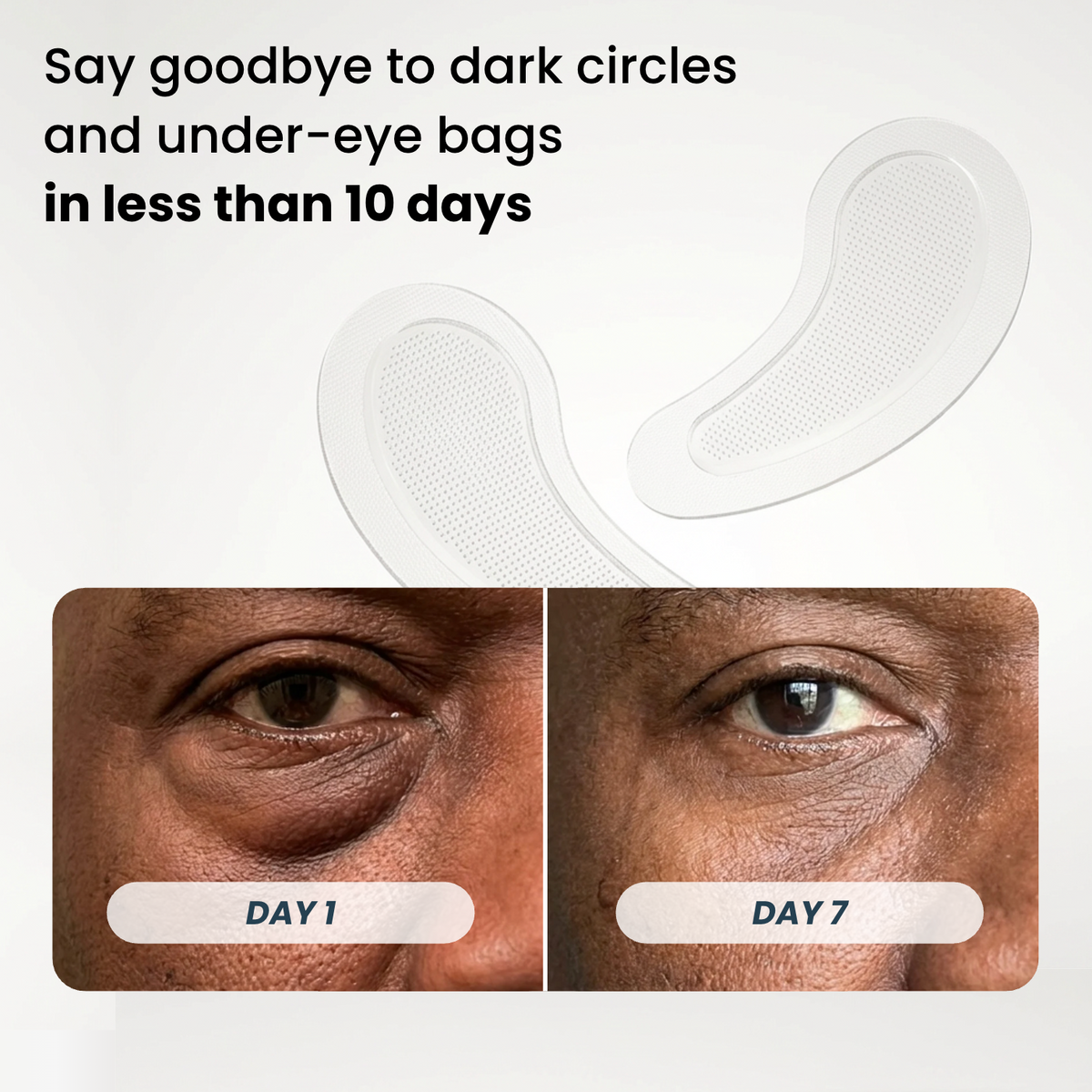 Microneedle Patches | New Generation